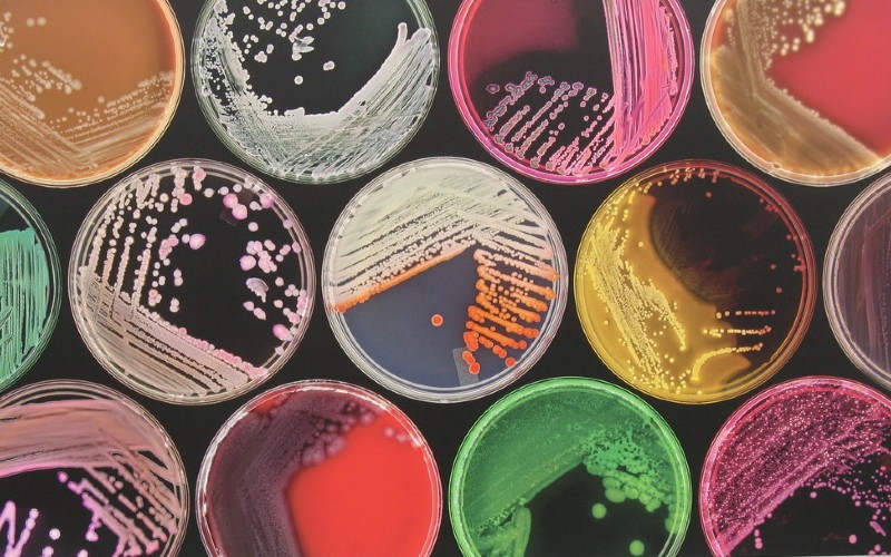 Multicoloured petri dishes with cultures of bacteria grown on agar jelly
